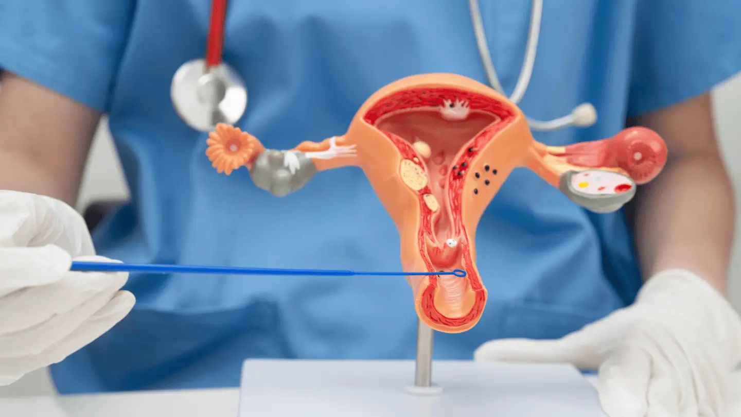 Cervical Cancer and HPV Vigilance